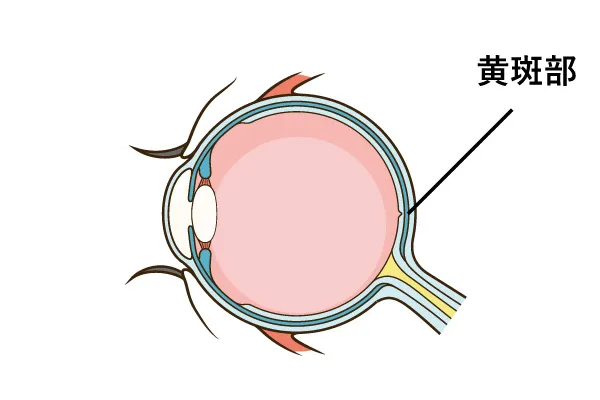 加齢黄斑変性症とは