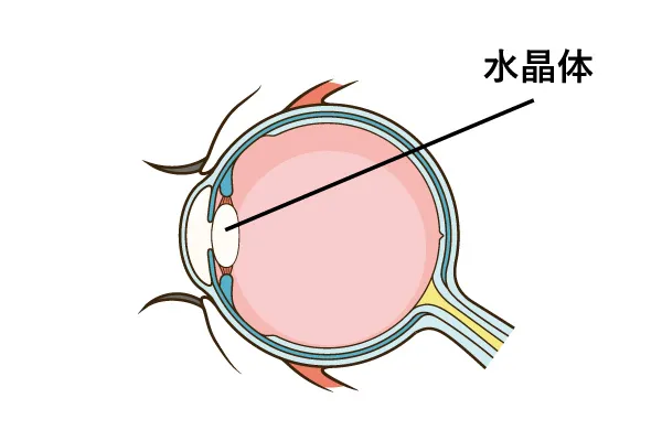 白内障とは