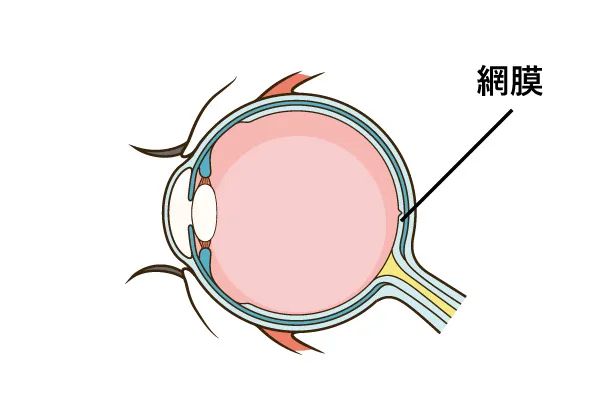 糖尿病網膜症とは