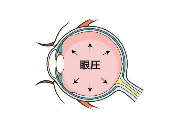 緑内障とは