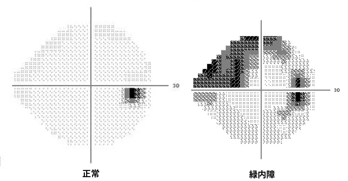 視野
